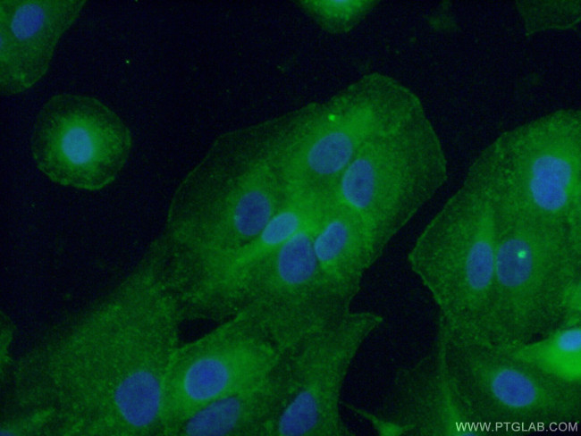 CD55 Antibody in Immunocytochemistry (ICC/IF)