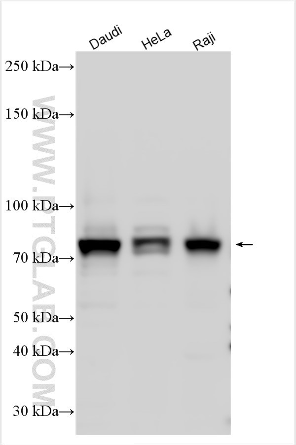 MTHFR Antibody in Western Blot (WB)