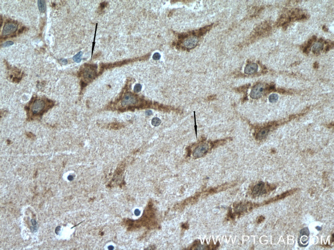 SIRPD Antibody in Immunohistochemistry (Paraffin) (IHC (P))