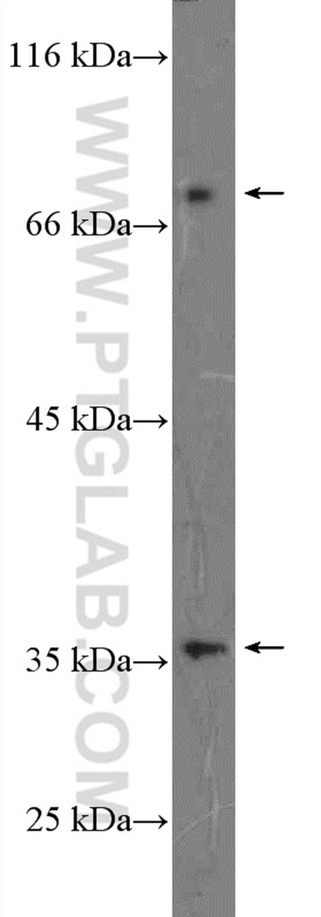 EPB41L4A Antibody in Western Blot (WB)