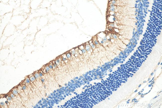CRB1 Antibody in Immunohistochemistry (Paraffin) (IHC (P))