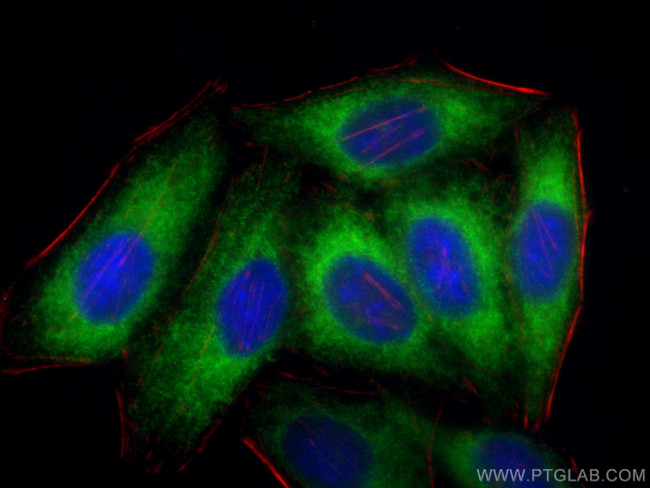 ELOVL5 Antibody in Immunocytochemistry (ICC/IF)