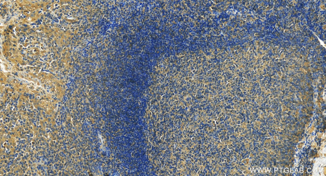 XCL1 Antibody in Immunohistochemistry (Paraffin) (IHC (P))