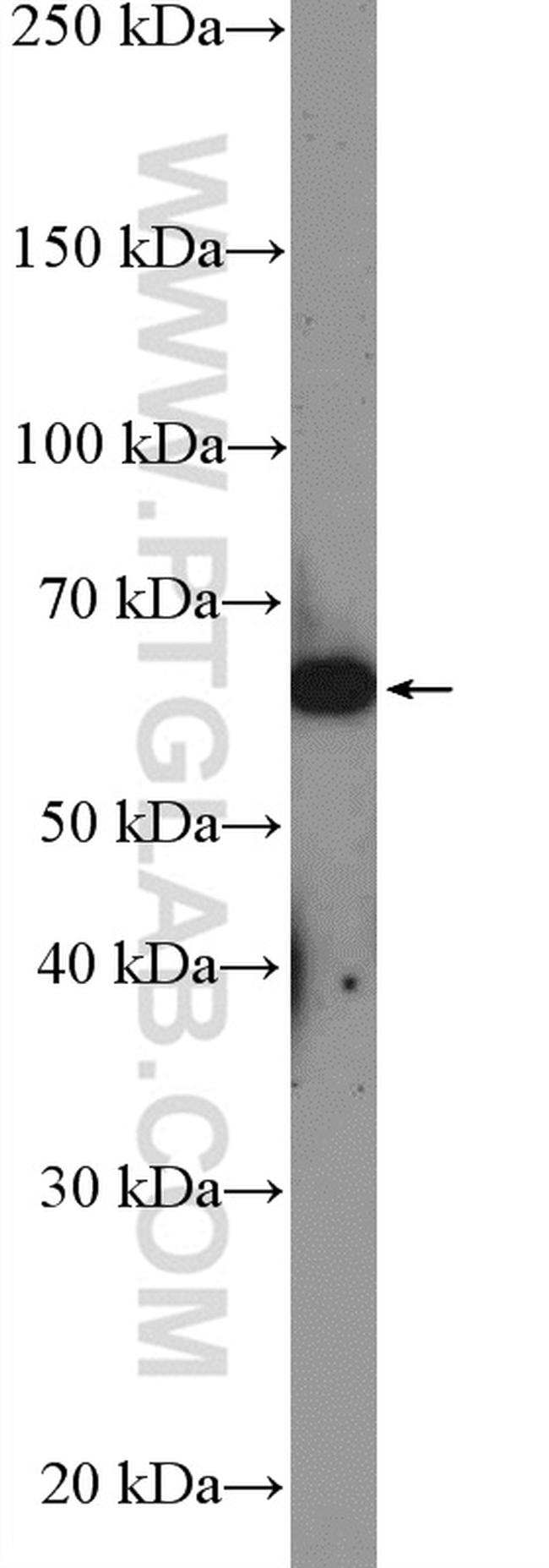 LOXL1 Antibody in Western Blot (WB)