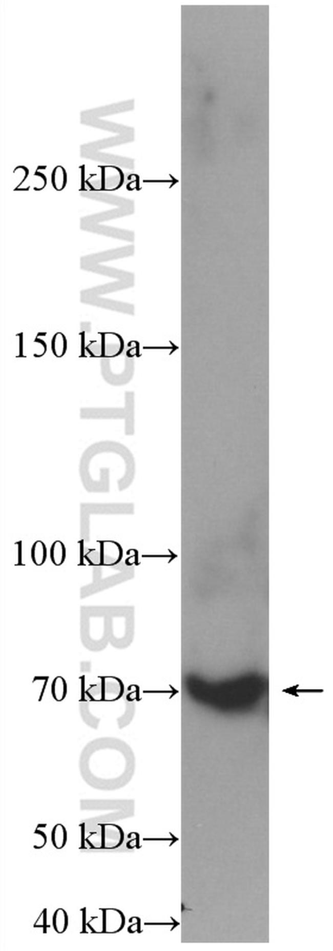 SAT1 Antibody in Western Blot (WB)