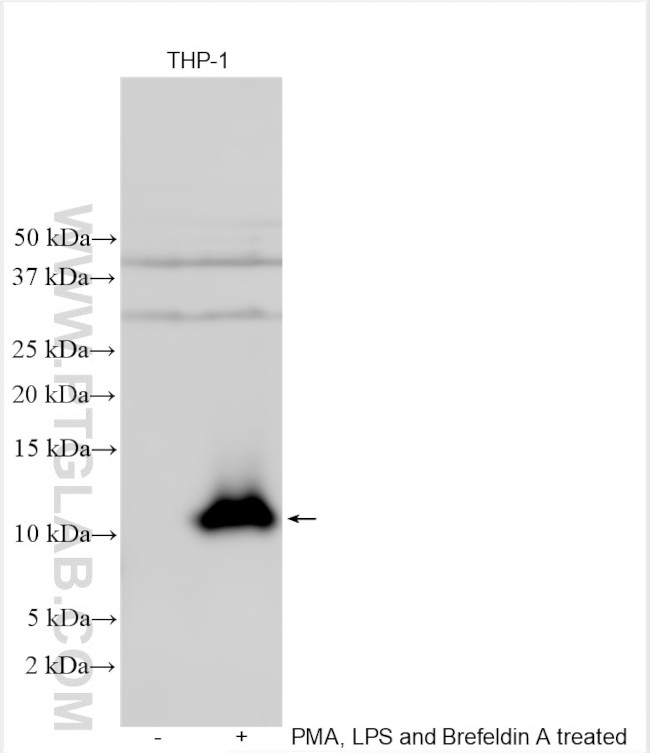 CCL4/MIP-1 beta Antibody in Western Blot (WB)