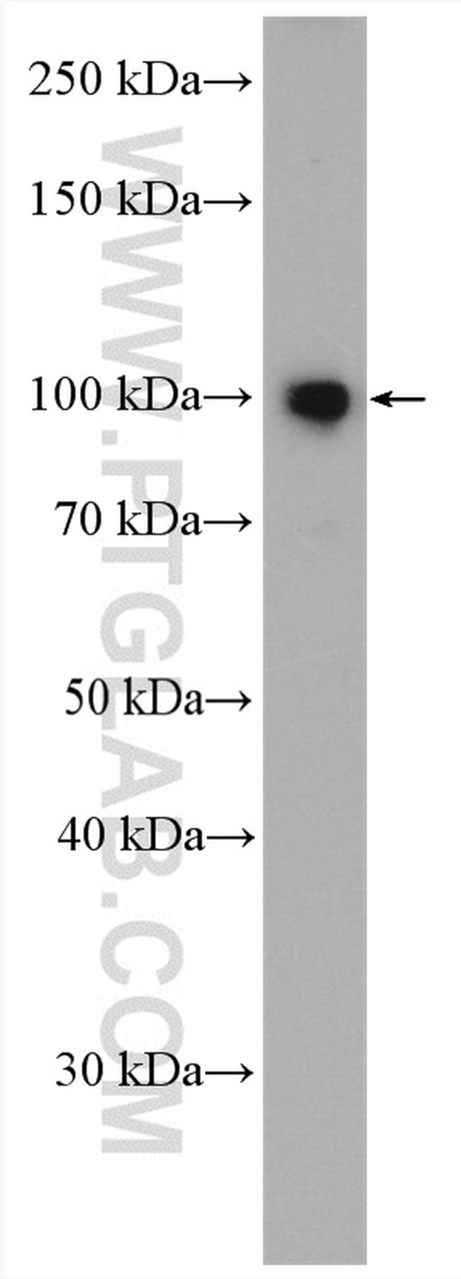 DRP2 Antibody in Western Blot (WB)
