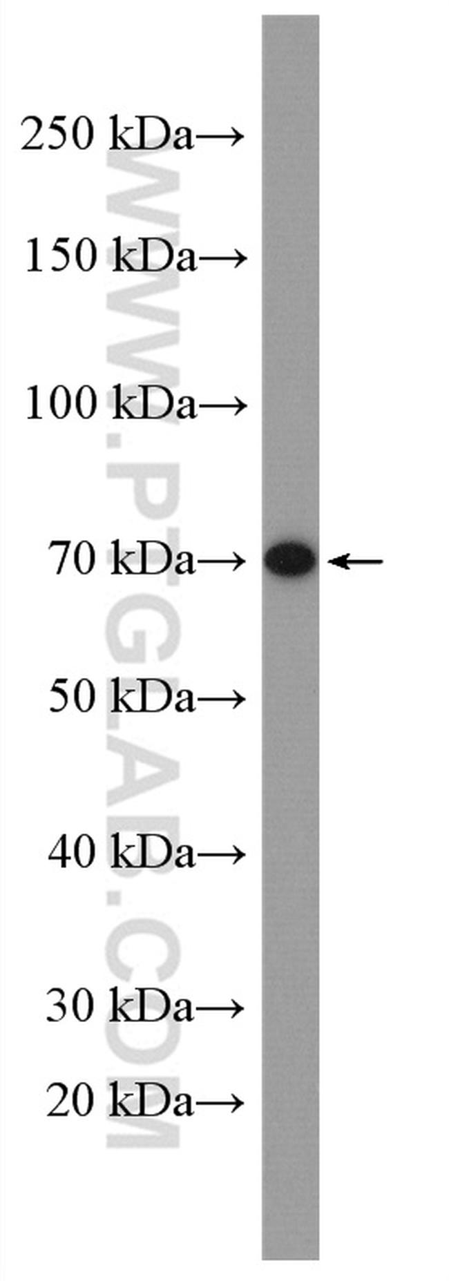 CATSPERB Antibody in Western Blot (WB)