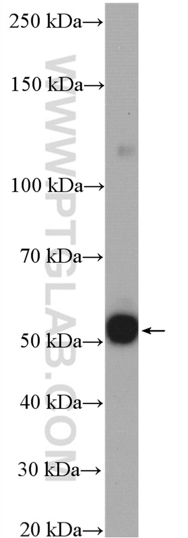 CFDP1 Antibody in Western Blot (WB)