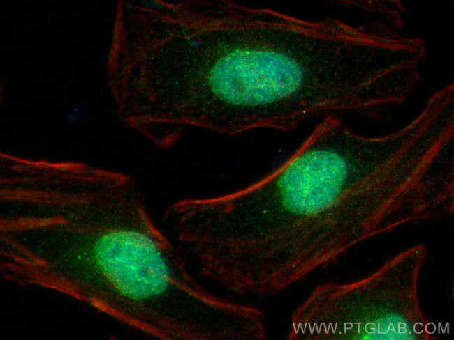 JMJD1C Antibody in Immunocytochemistry (ICC/IF)