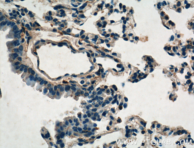 TIMP2 Antibody in Immunohistochemistry (Paraffin) (IHC (P))