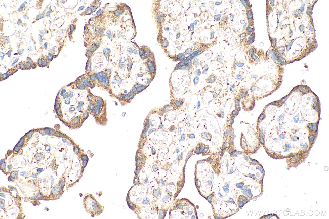 ADAMTSL3 Antibody in Immunohistochemistry (Paraffin) (IHC (P))
