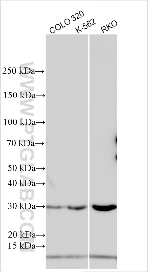 DENND4A Antibody in Western Blot (WB)