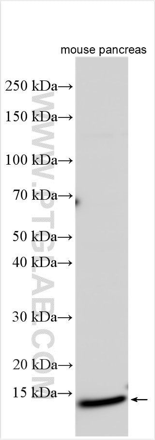 SYCN Antibody in Western Blot (WB)