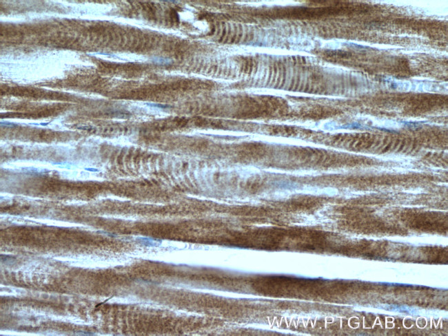 Calsequestrin Antibody in Immunohistochemistry (Paraffin) (IHC (P))