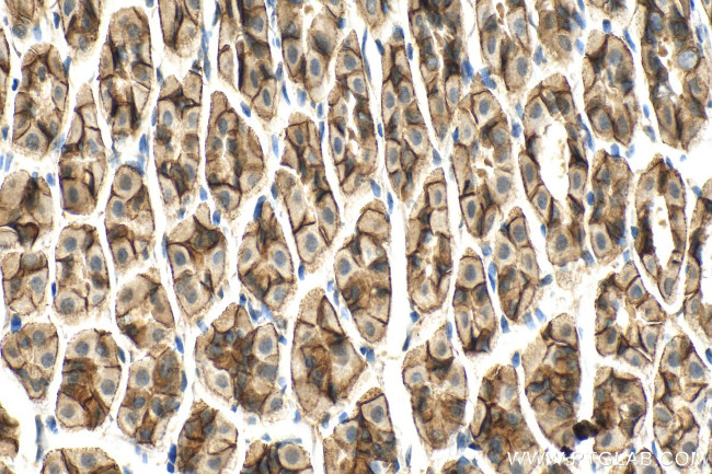 INPPL1 Antibody in Immunohistochemistry (Paraffin) (IHC (P))