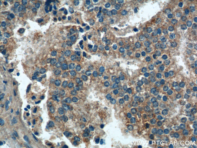 PARL Antibody in Immunohistochemistry (Paraffin) (IHC (P))