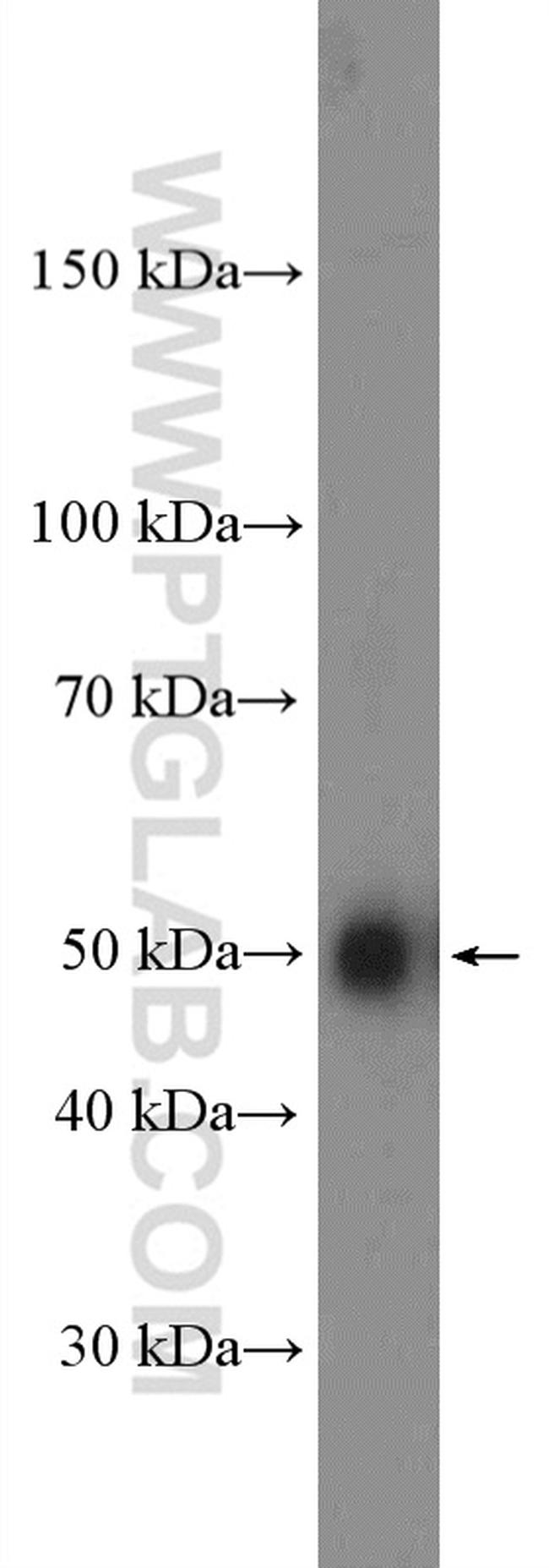 ATP6V1H Antibody in Western Blot (WB)