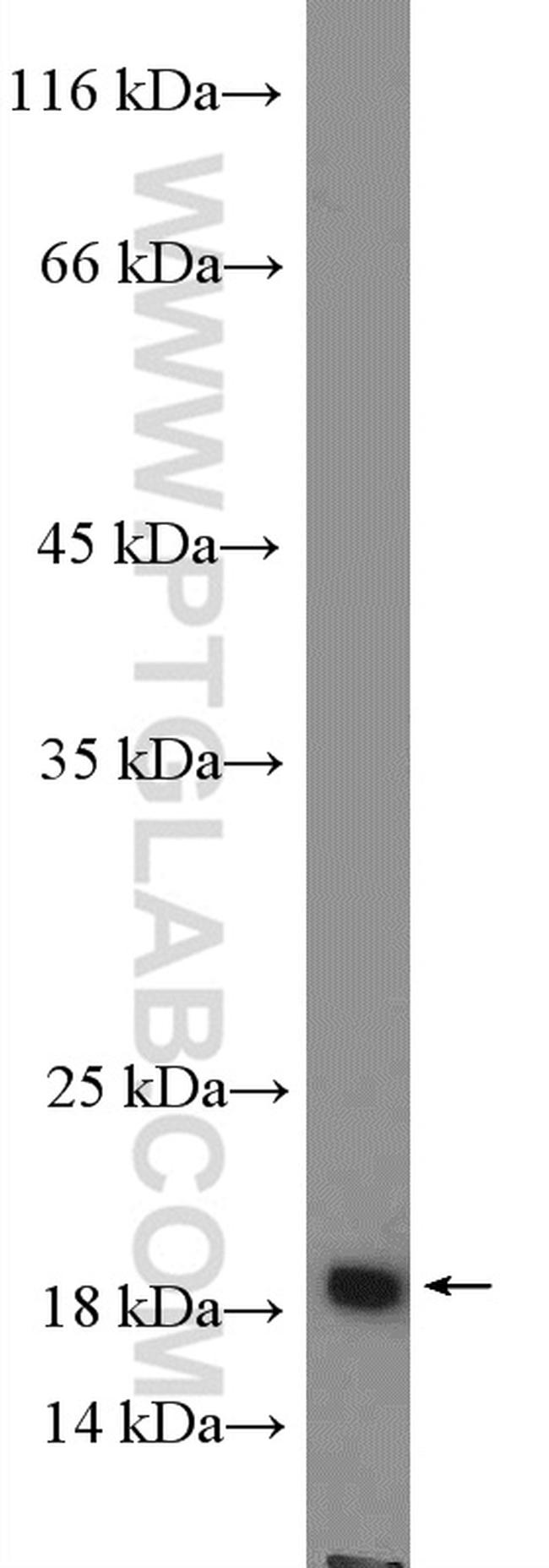 SSPN Antibody in Western Blot (WB)