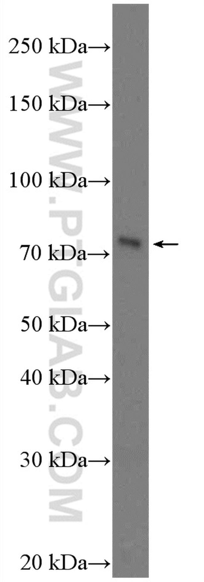 BTN1A1 Antibody in Western Blot (WB)