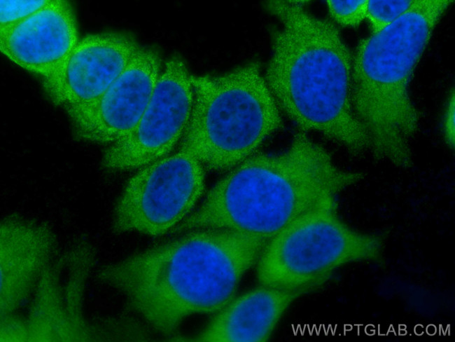 BMPR1B Antibody in Immunocytochemistry (ICC/IF)