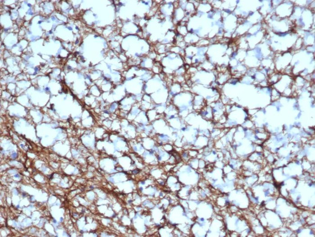 GFAP (Astrocyte and Neural Stem Cell Marker) Antibody in Immunohistochemistry (Paraffin) (IHC (P))