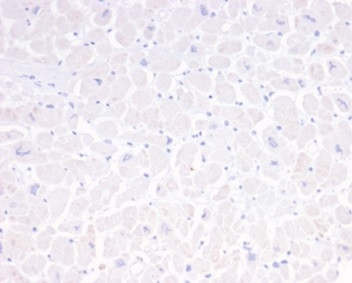 GFAP (Astrocyte and Neural Stem Cell Marker) Antibody in Immunohistochemistry (Paraffin) (IHC (P))