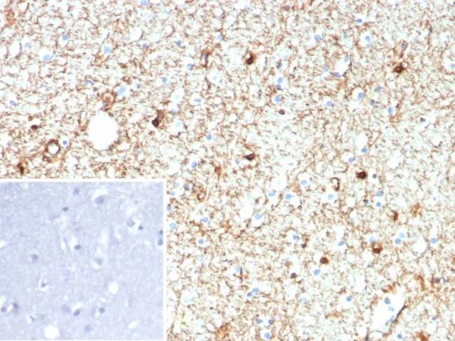 GFAP (Astrocyte and Neural Stem Cell Marker) Antibody in Immunohistochemistry (Paraffin) (IHC (P))