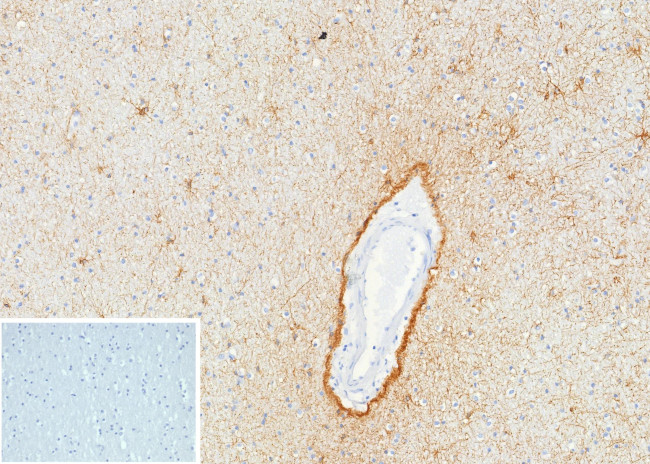 GFAP (Astrocyte and Neural Stem Cell Marker) Antibody in Immunohistochemistry (Paraffin) (IHC (P))