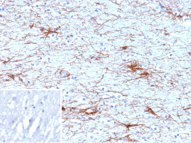 GFAP (Astrocyte and Neural Stem Cell Marker) Antibody in Immunohistochemistry (Paraffin) (IHC (P))