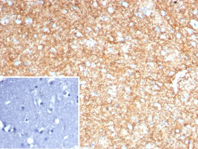 GFAP (Astrocyte and Neural Stem Cell Marker) Antibody in Immunohistochemistry (Paraffin) (IHC (P))