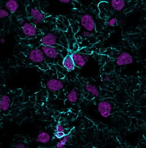 GFAP (Astrocyte and Neural Stem Cell Marker) Antibody in Immunocytochemistry (ICC/IF)