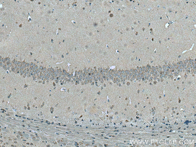 STX5 Antibody in Immunohistochemistry (Paraffin) (IHC (P))