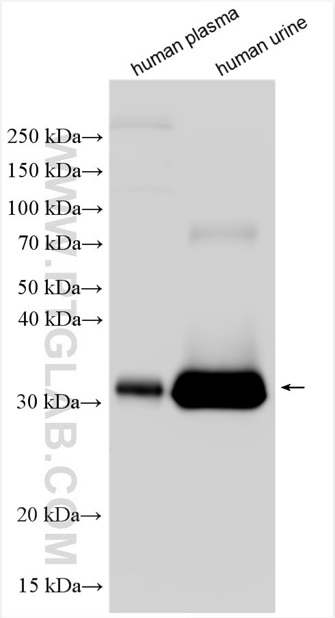 Alpha 1 microglobulin Antibody in Western Blot (WB)