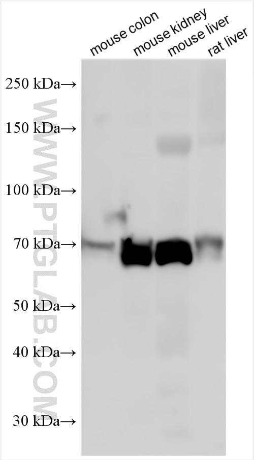 ABCD3 Antibody in Western Blot (WB)