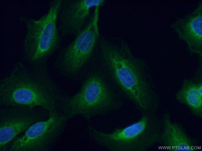 DNAJC3 Antibody in Immunocytochemistry (ICC/IF)