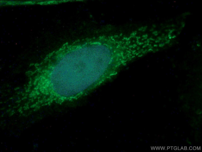 ATP8 Antibody in Immunocytochemistry (ICC/IF)