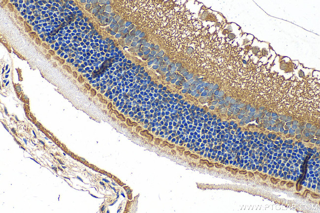 SLC6A6/TAUT Antibody in Immunohistochemistry (Paraffin) (IHC (P))