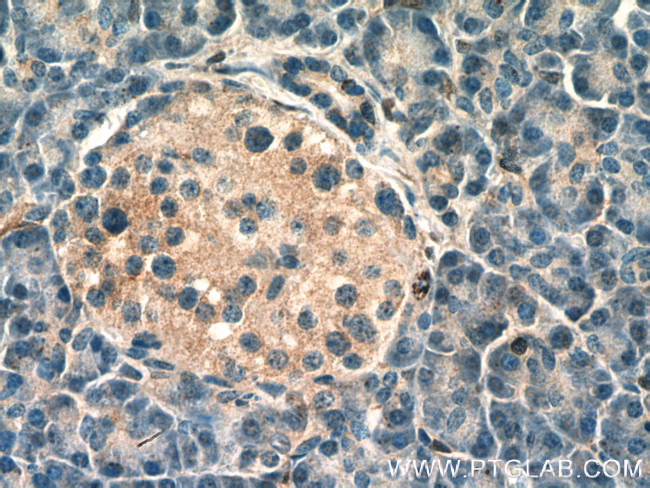 FAM176A Antibody in Immunohistochemistry (Paraffin) (IHC (P))
