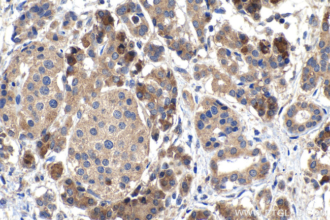 SNX10 Antibody in Immunohistochemistry (Paraffin) (IHC (P))