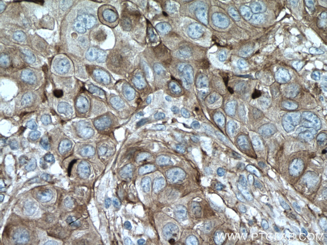 CYBRD1 Antibody in Immunohistochemistry (Paraffin) (IHC (P))