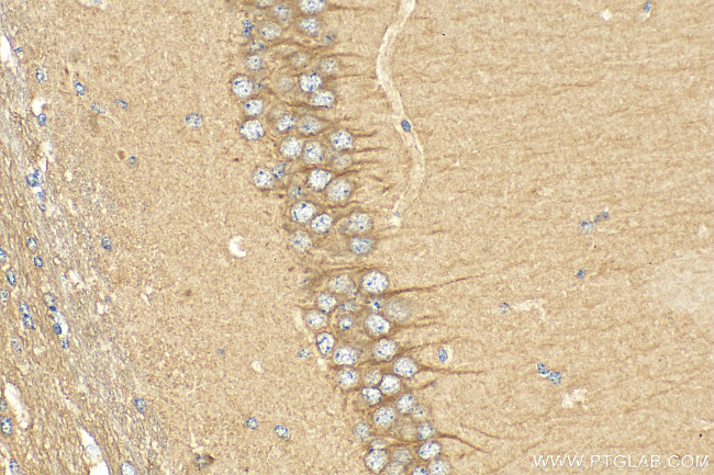 GPBAR1 Antibody in Immunohistochemistry (Paraffin) (IHC (P))