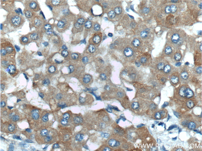 ENTPD5 Antibody in Immunohistochemistry (Paraffin) (IHC (P))