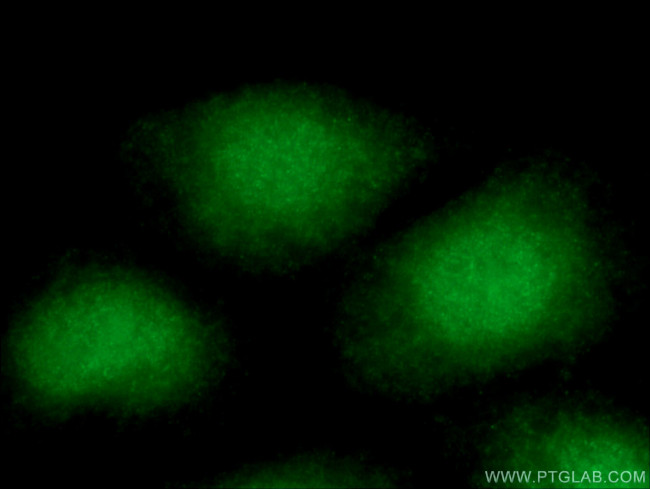 APTX Antibody in Immunocytochemistry (ICC/IF)
