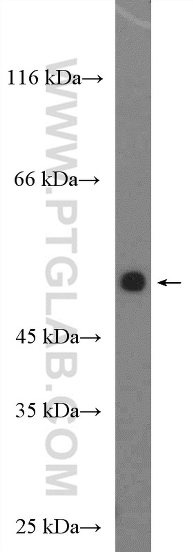 DIRC2 Antibody in Western Blot (WB)