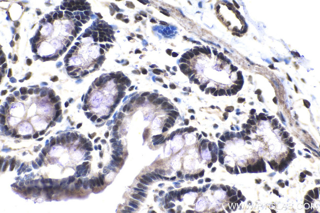 SFRS11 Antibody in Immunohistochemistry (Paraffin) (IHC (P))