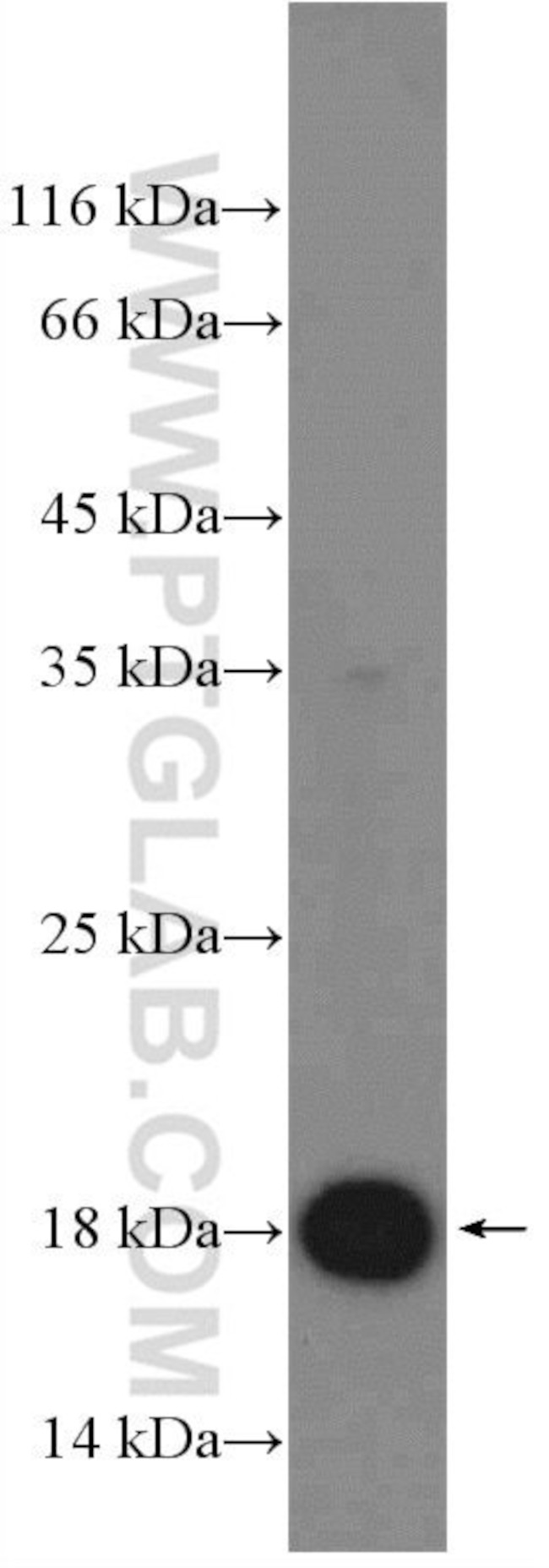 Cas9 Antibody in Western Blot (WB)