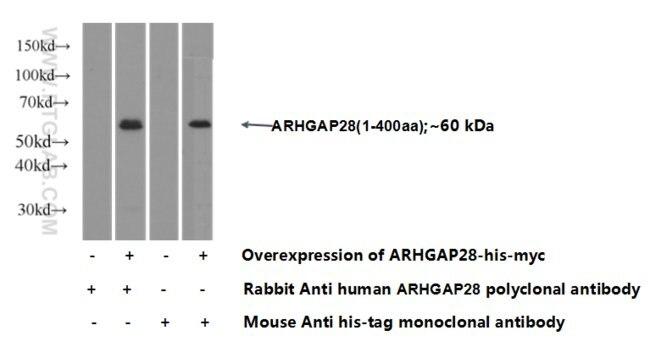 ARHGAP28 Antibody in Western Blot (WB)