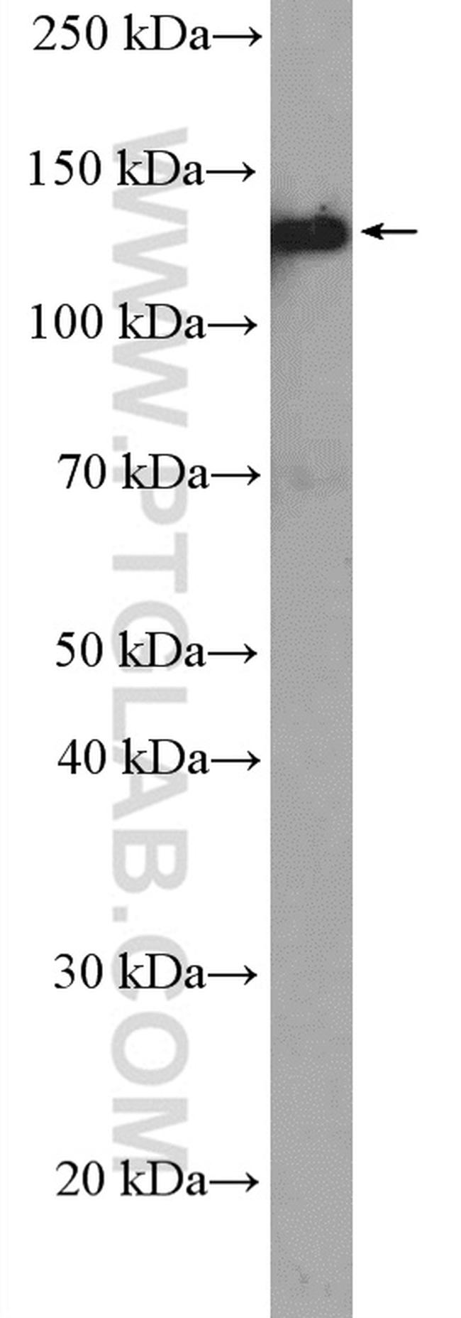 LAMB3 Antibody in Western Blot (WB)