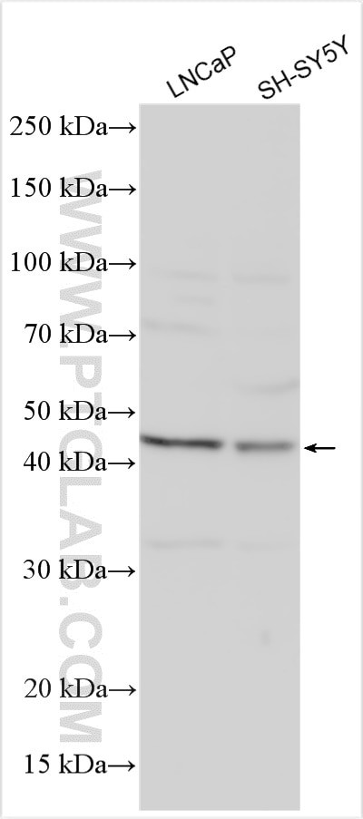 TREK1/KCNK2 Antibody in Western Blot (WB)